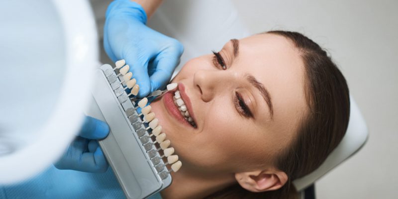 Rodzaje licówek dentystycznych i ich zalety
