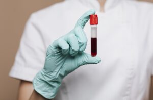 Badanie nerek z krwi – klucz do zdrowia układu moczowego