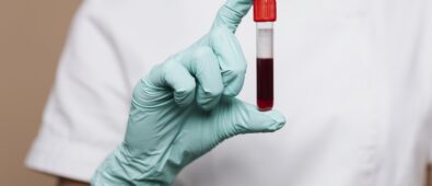 Badanie nerek z krwi – klucz do zdrowia układu moczowego